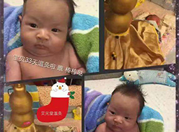 童艾康案例